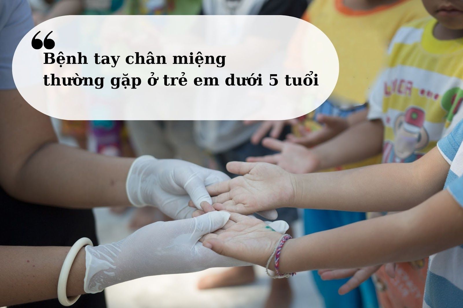 Bệnh tay chân miệng xảy ra phổ biến ở trẻ dưới 5 tuổi (Nguồn: Canva)