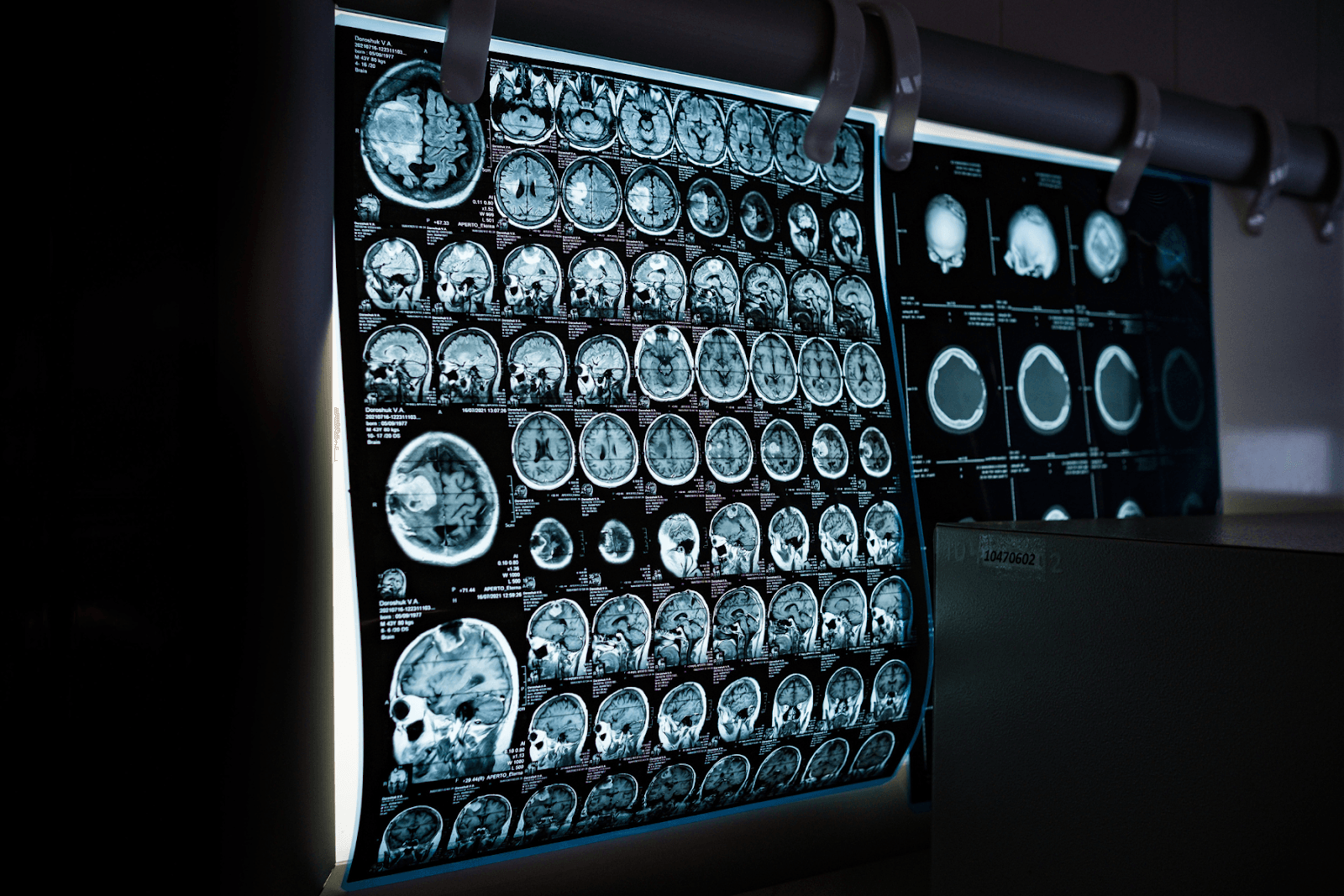 Chụp MRI cho hình ảnh sắc nét và chi tiết