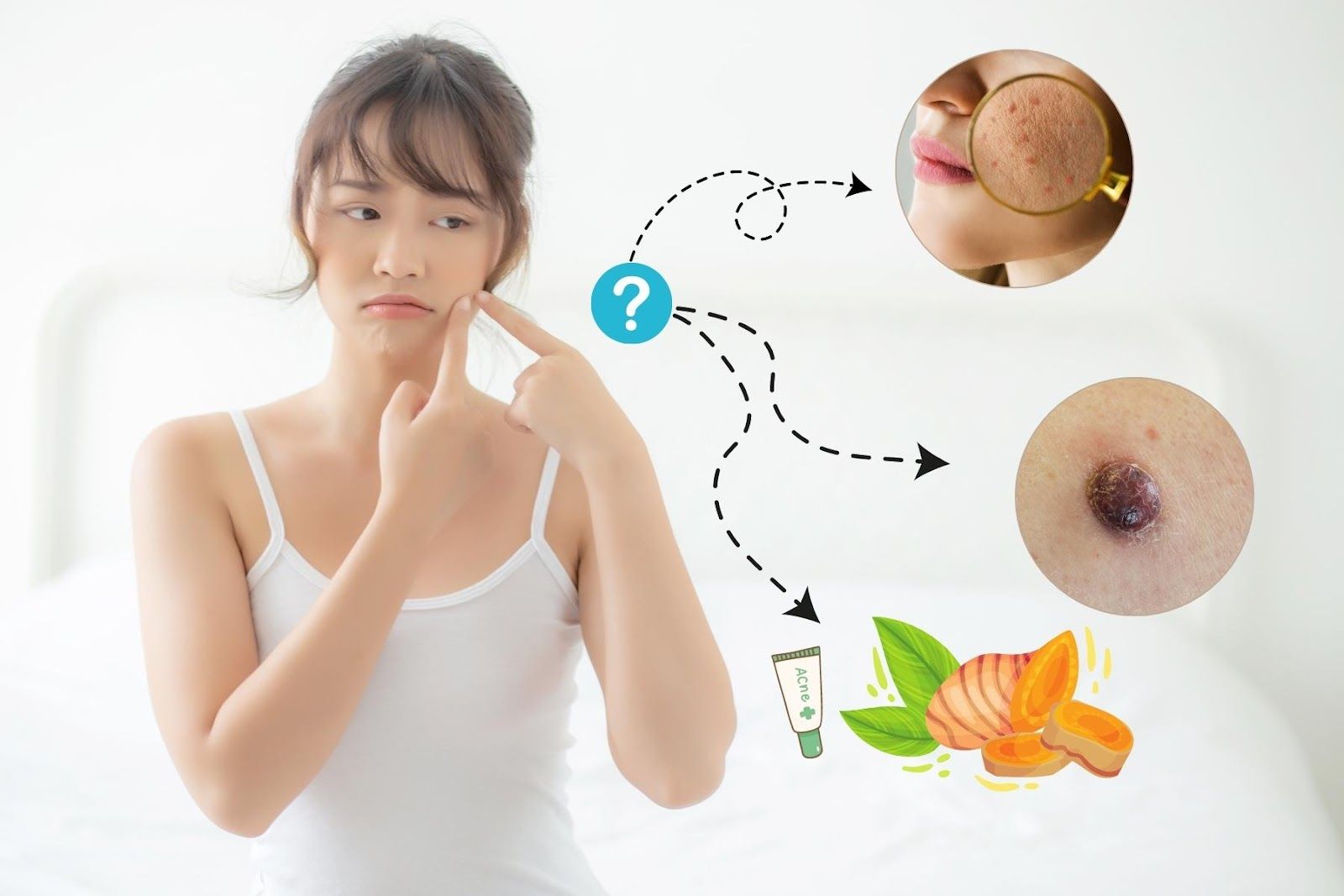 Quá nhiều nỗi lo sau khi tẩy nốt ruồi - Nguồn ảnh: Canva