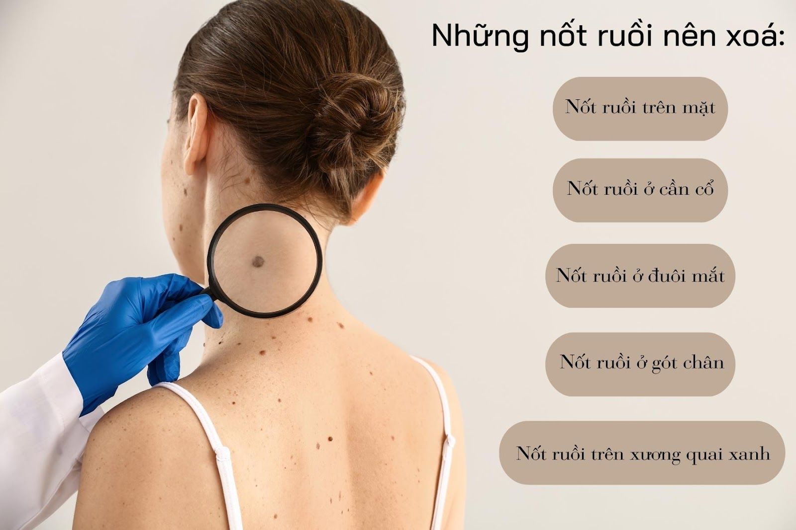 Những vị trí nốt ruồi được khuyên nên tẩy - Nguồn ảnh: Canva