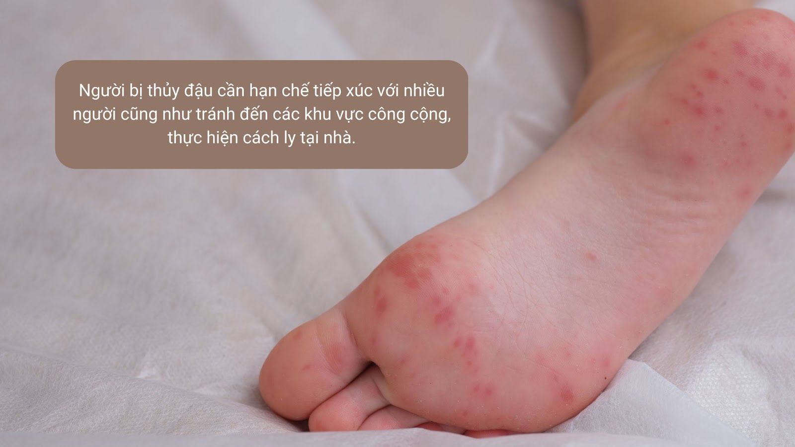Người bệnh nên thực hiện cách ly tại nhà - Nguồn: Canva