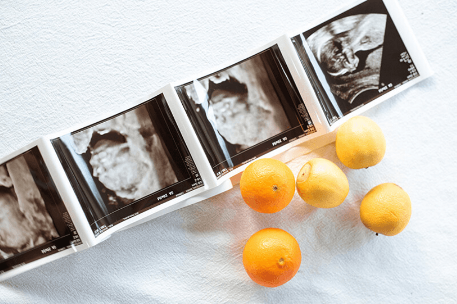 Bảo hiểm chăm sóc sức khỏe thai sản là sản phẩm của công ty bảo hiểm, với nhiều quyền lợi mở rộng cho mẹ và bé