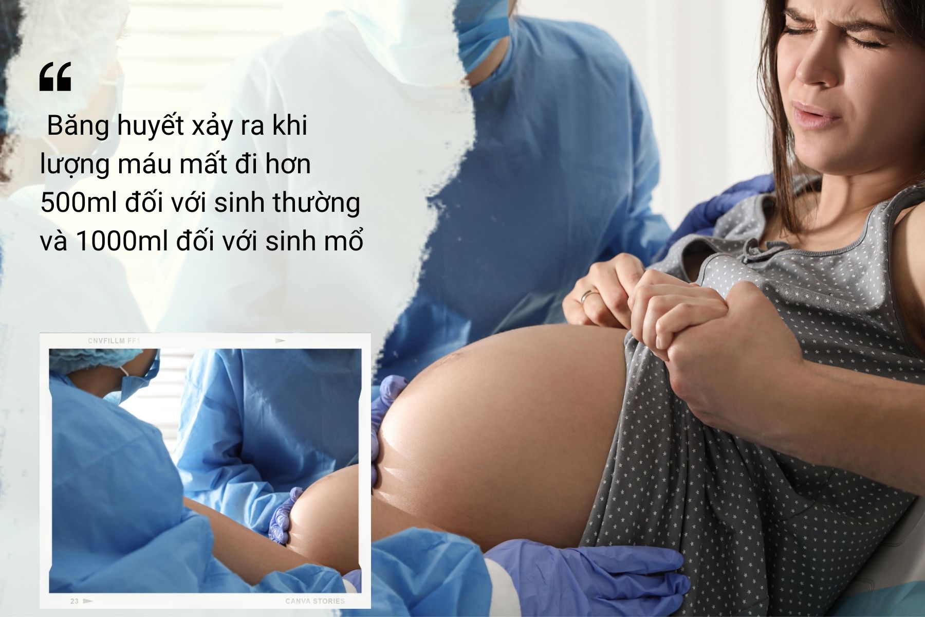 Hiện tượng băng huyết thường xảy ra ở sản phụ sau khi sinh nở