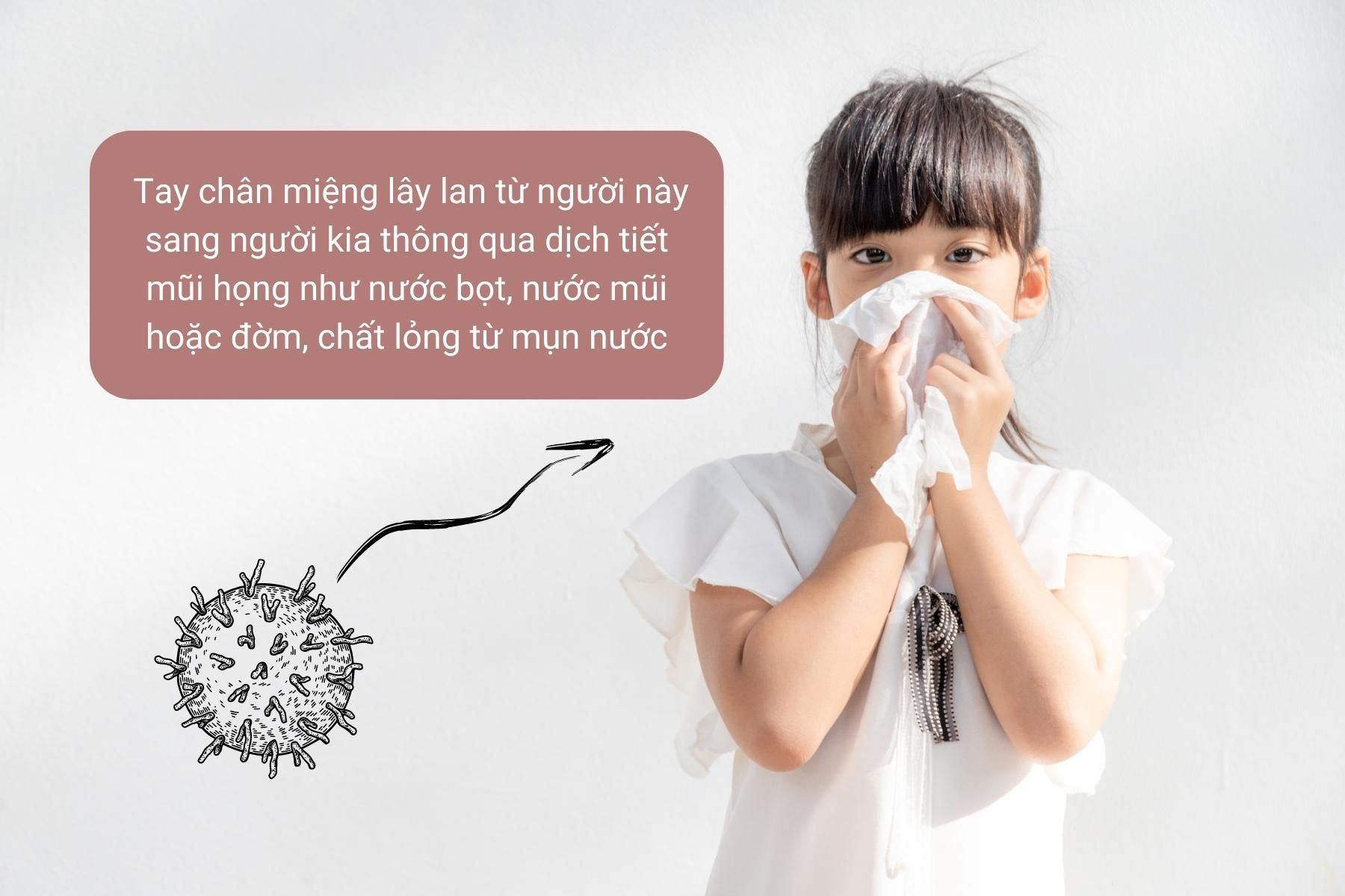 Bệnh tay chân miệng lây lan thông qua dịch tiết mũi họng - Nguồn ảnh: Canva