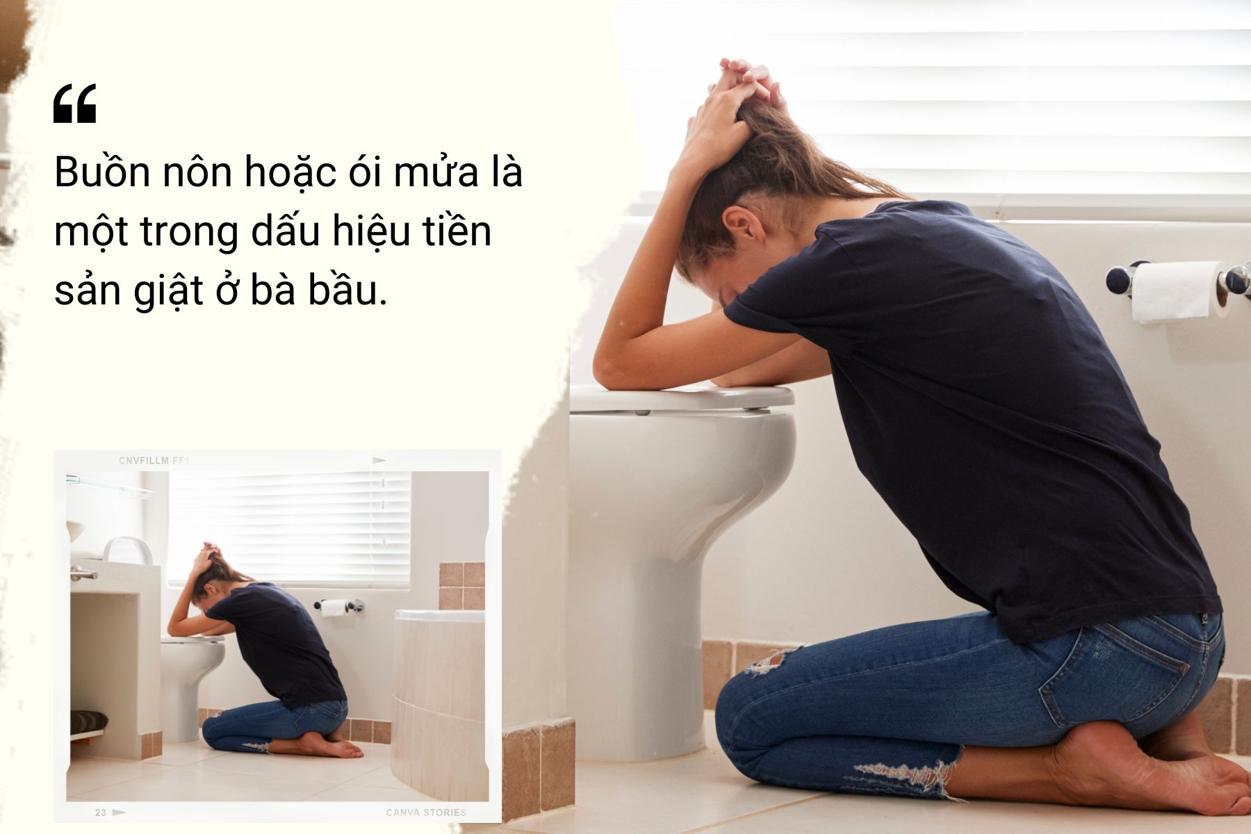 &nbsp;Dấu hiệu tiền sản giật ở bà bầu