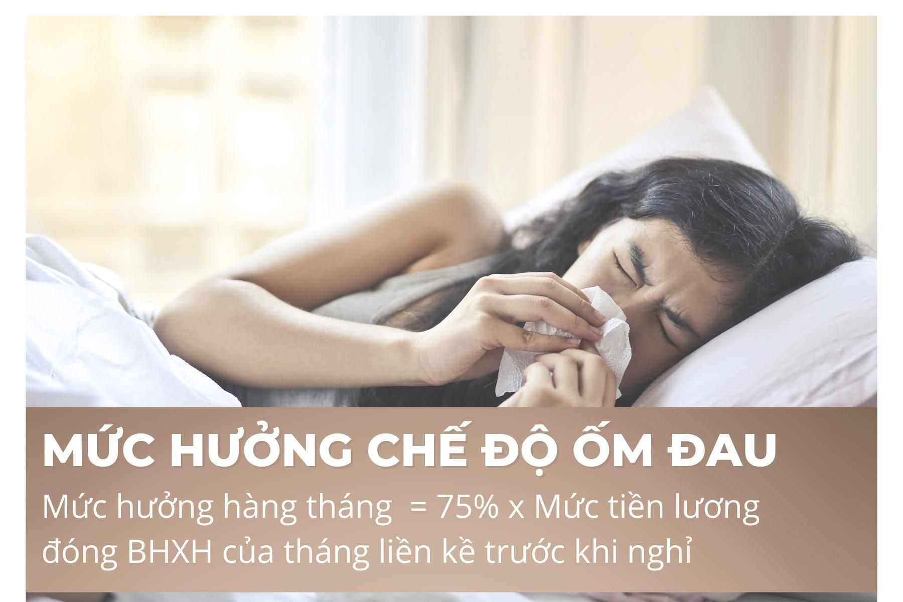 Mức hưởng được quy định tại Điều 28 Luật Bảo hiểm xã hội 2014