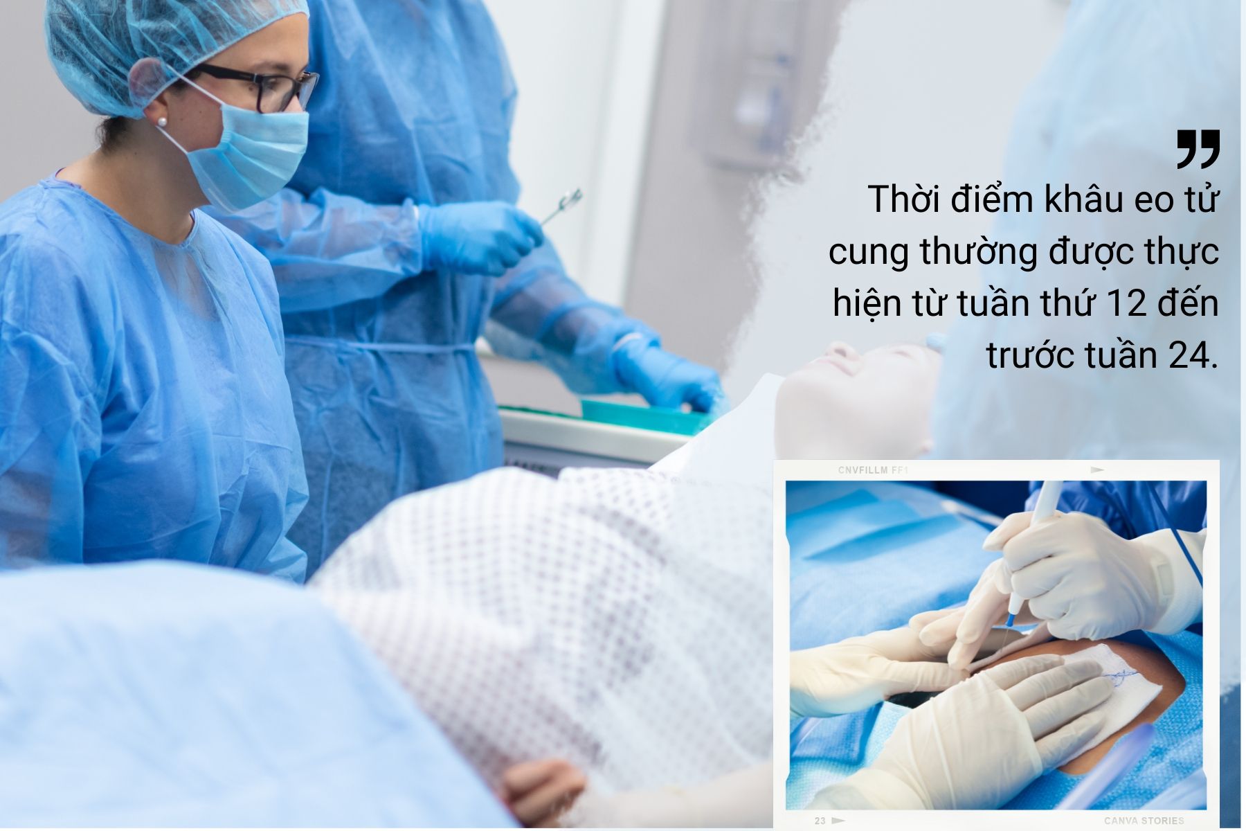 Khâu eo cổ tử cung sẽ không được thực hiện ở 3 tháng cuối thai kỳ