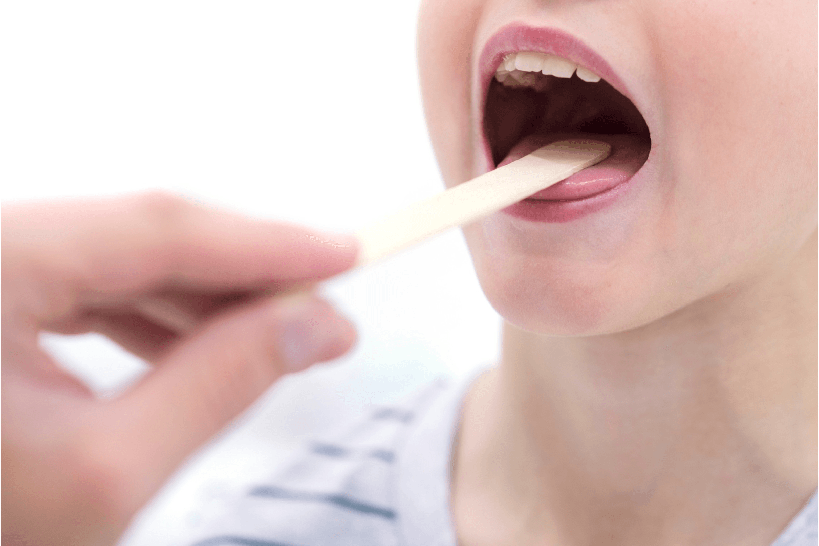 Nhiệt miệng ở lưỡi gây đau nhức, khó chịu