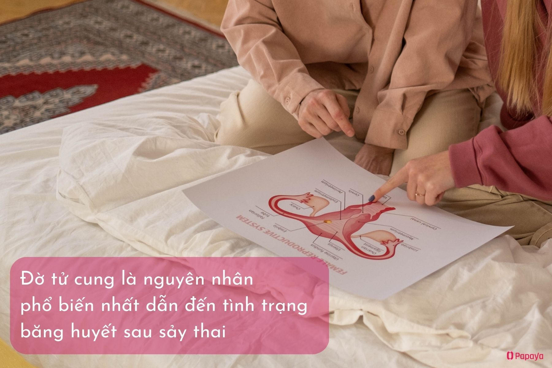 Nguyên nhân gây băng huyết sau sảy thai