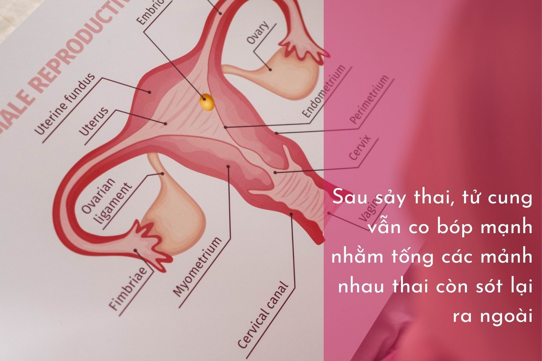 Nguyên nhân gây đau bụng dưới sau sảy thai
