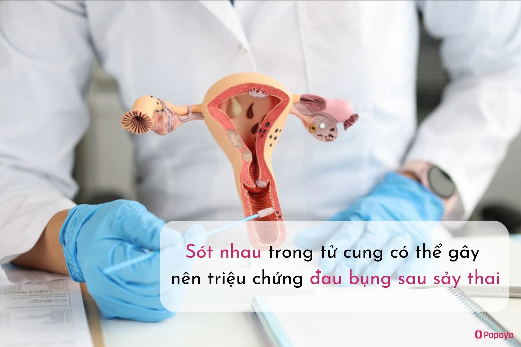 Nguyên nhân gây đau bụng sau sảy thai