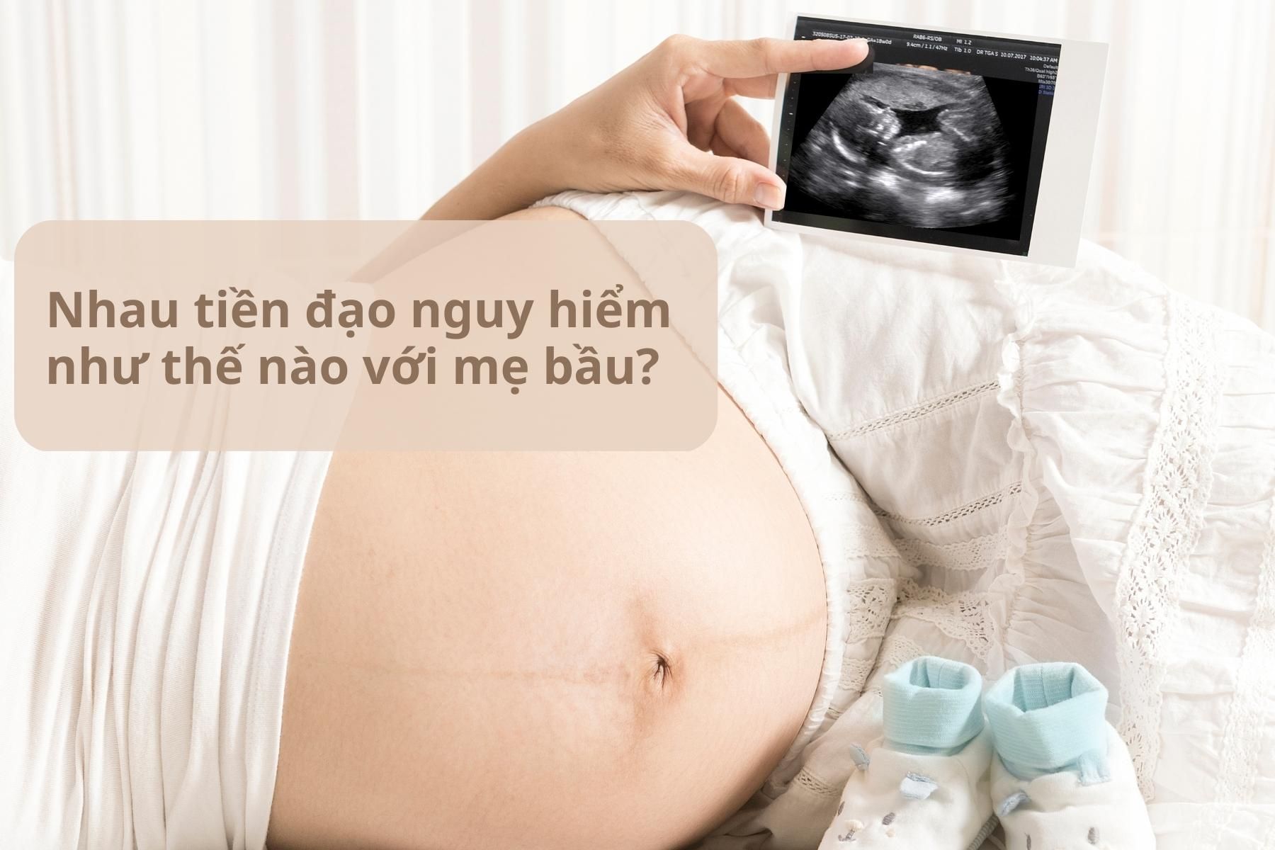 Nhau tiền đạo là biến chứng nguy hiểm ảnh hưởng tới sức khỏe mẹ và bé