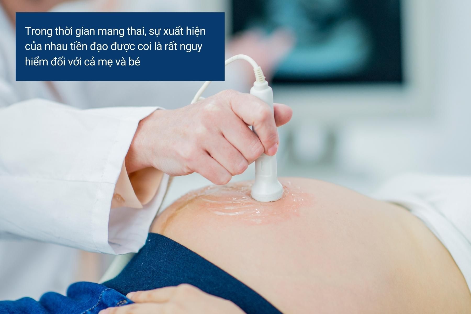 Khi sản phụ mắc nhau tiền đạo thì nên được nghỉ ngơi, hạn chế việc đi lại
