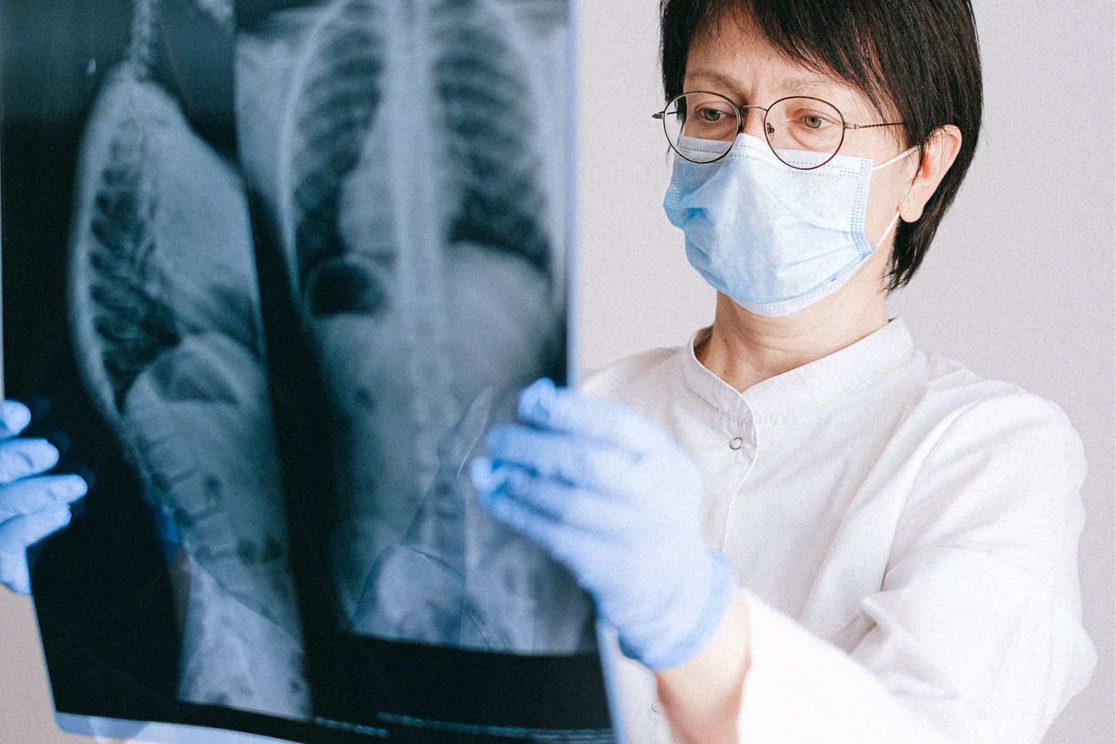 Chụp X quang phổi là cách để chẩn đoán bệnh viêm phổi thùy (Nguồn: Canva)