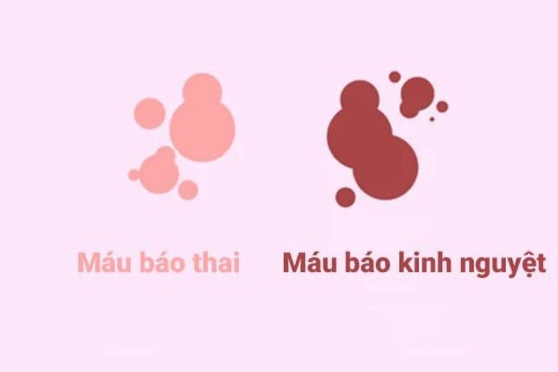 Phân biệt máu báo thai và máu báo kinh nguyệt (Nguồn: Internet)