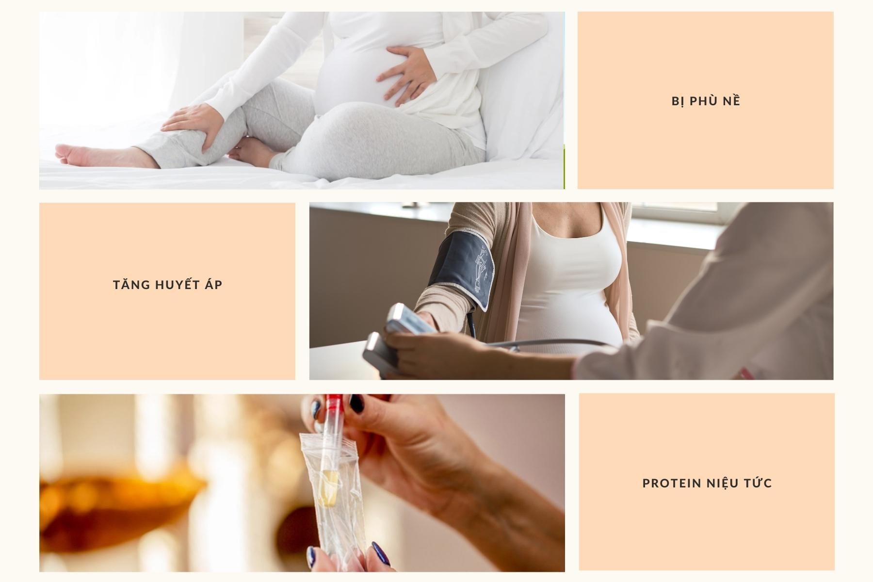 Biểu hiện của tiền sản giật trong thai kỳ
