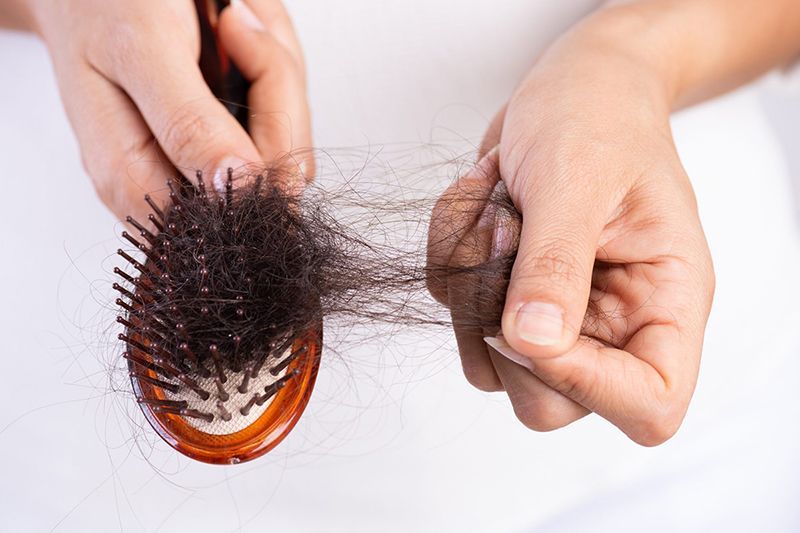 Tóc rụng là dấu hiệu cho thấy bạn đang bị áp lực trong công việc rất nghiêm trọng