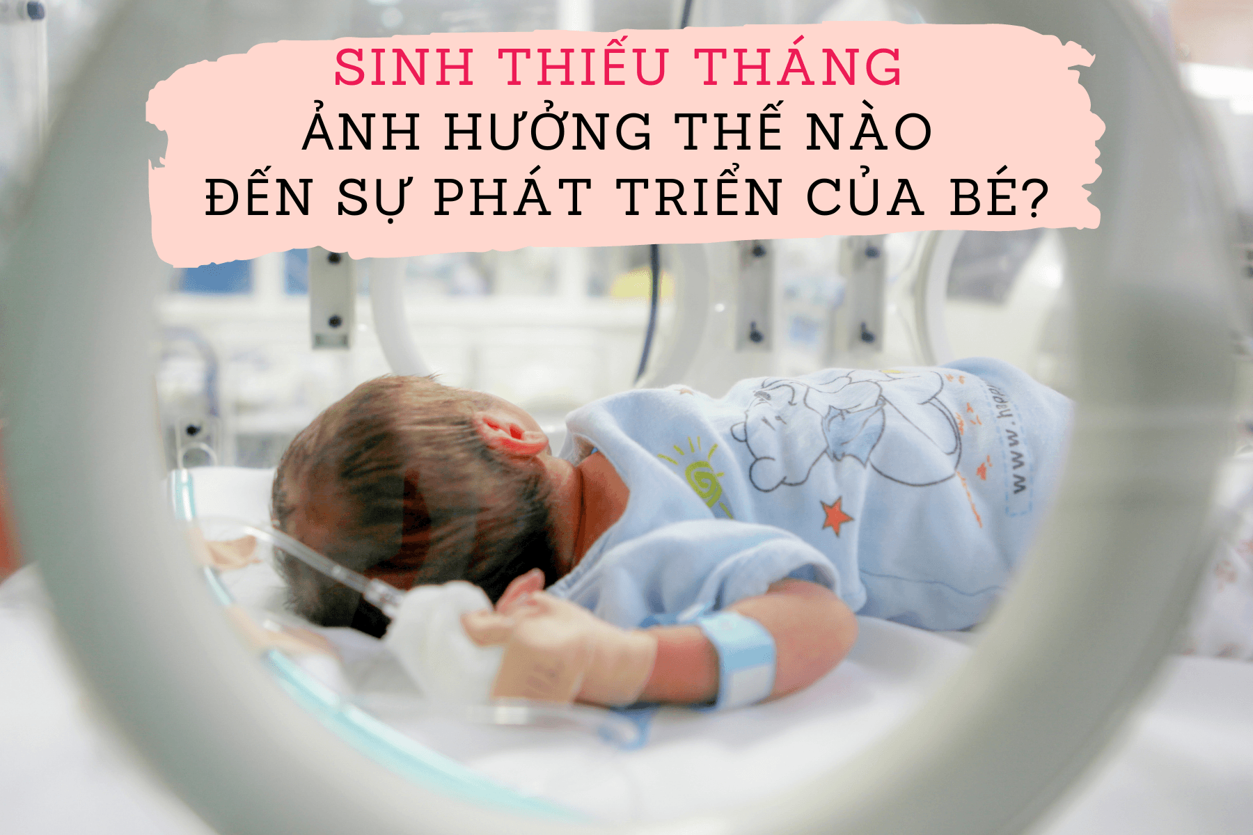 Sinh non ảnh hưởng thế nào đến sự phát triển của bé