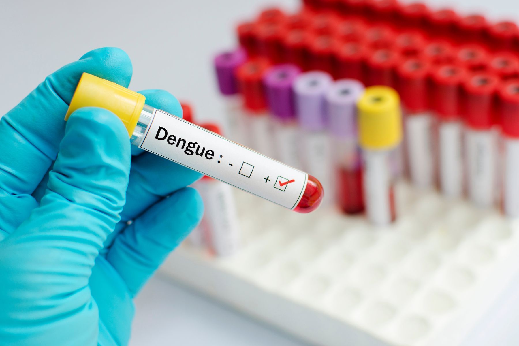 sot-xuat-huyet-dengue.jpg