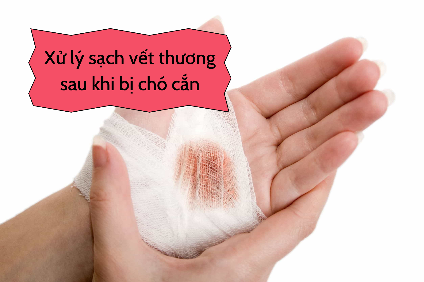 Cách xử lý vết thương sau khi bị chó cắn.