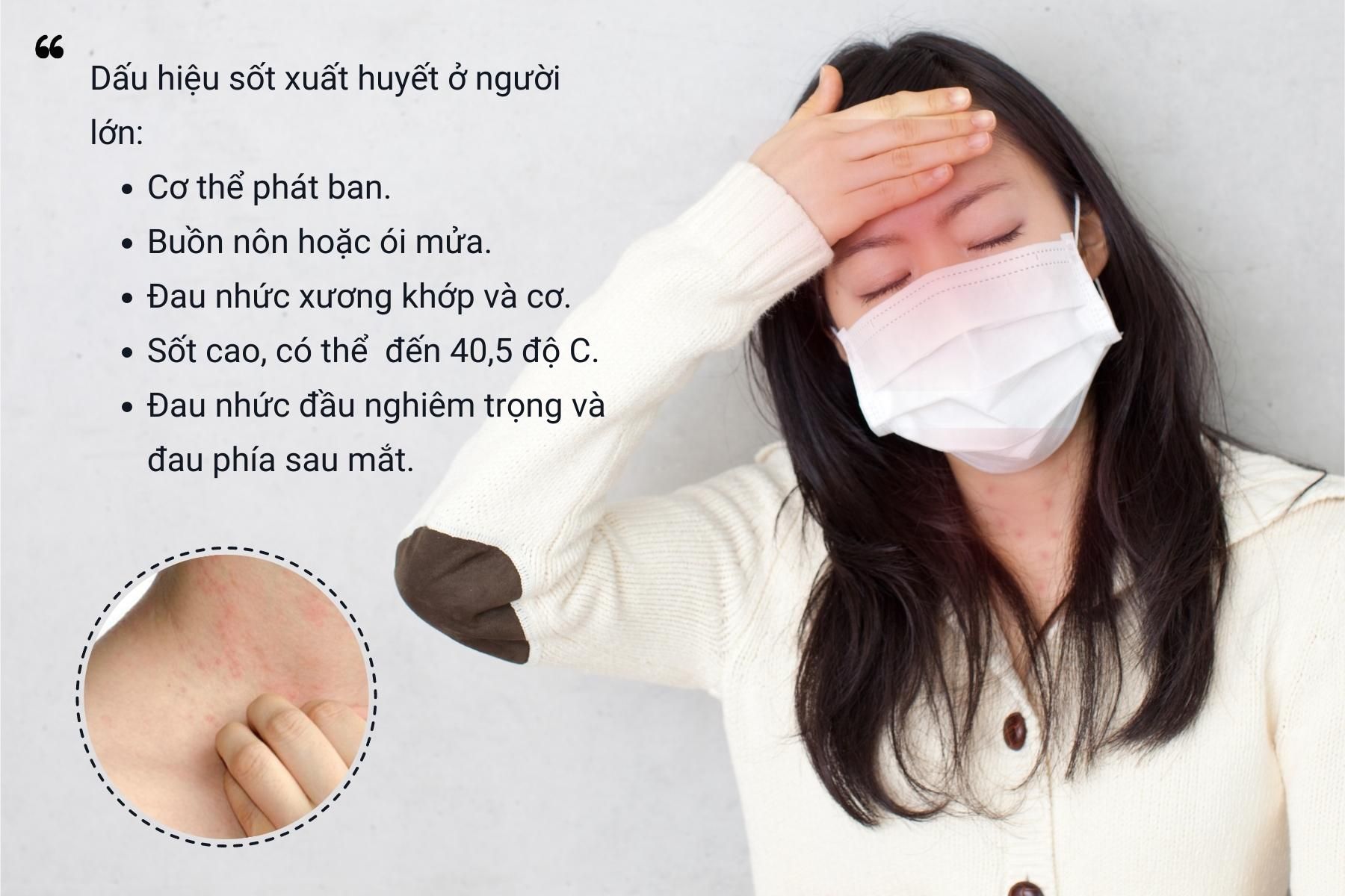  Triệu chứng nhẹ của sốt xuất huyết ở người lớn - Nguồn ảnh: Freepik