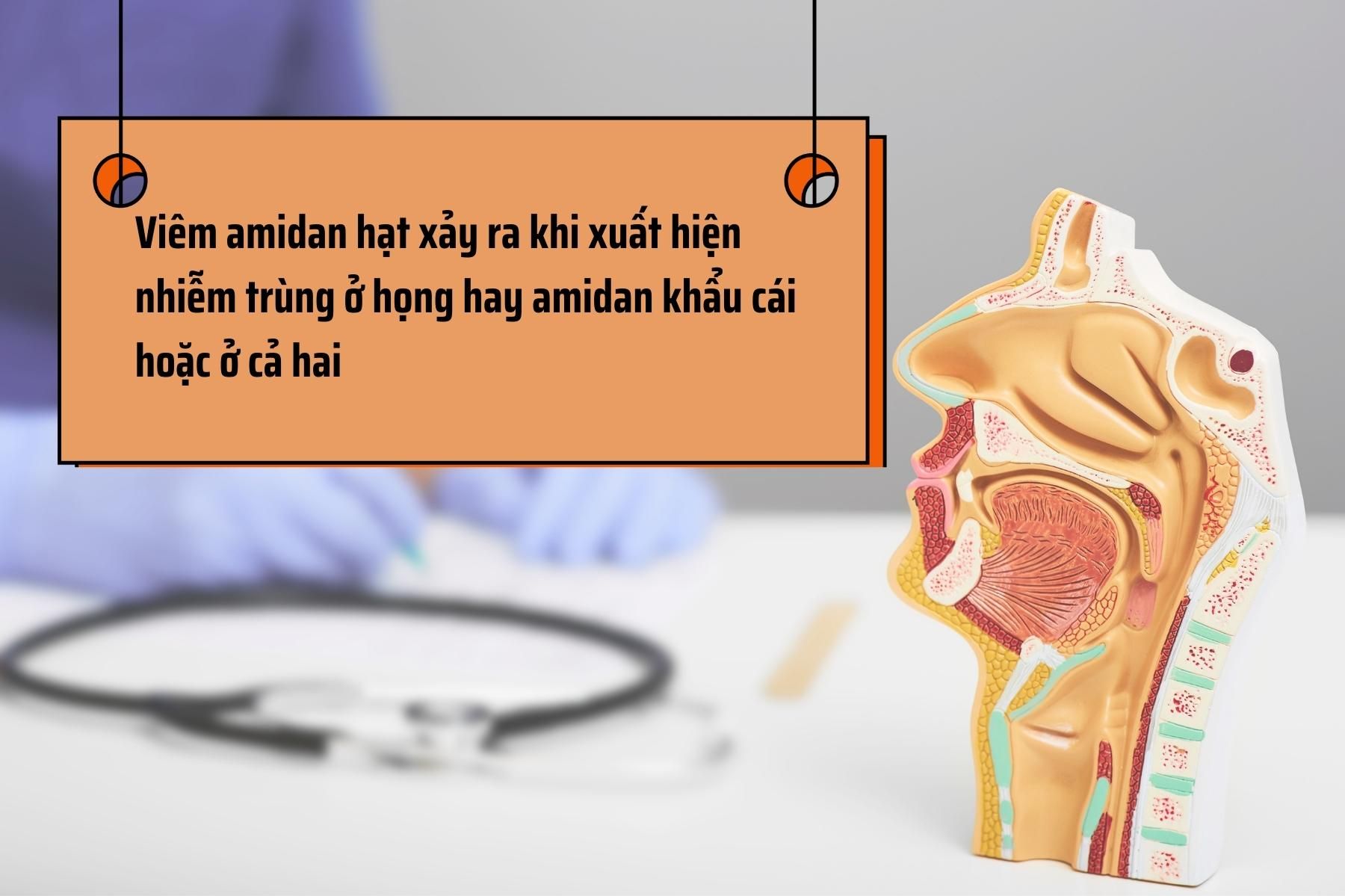 Viêm amidan xuất hiện ở khẩu cái hay họng (Nguồn: Canva)