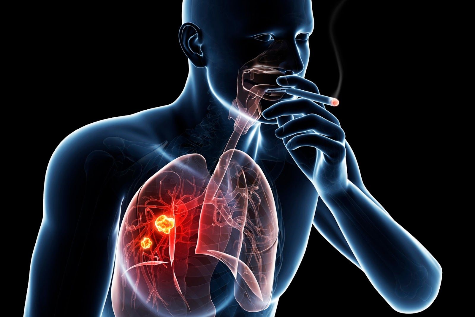 Hút thuốc lá thường xuyên tăng nguy cơ bị viêm phổi (Nguồn: Canva)
