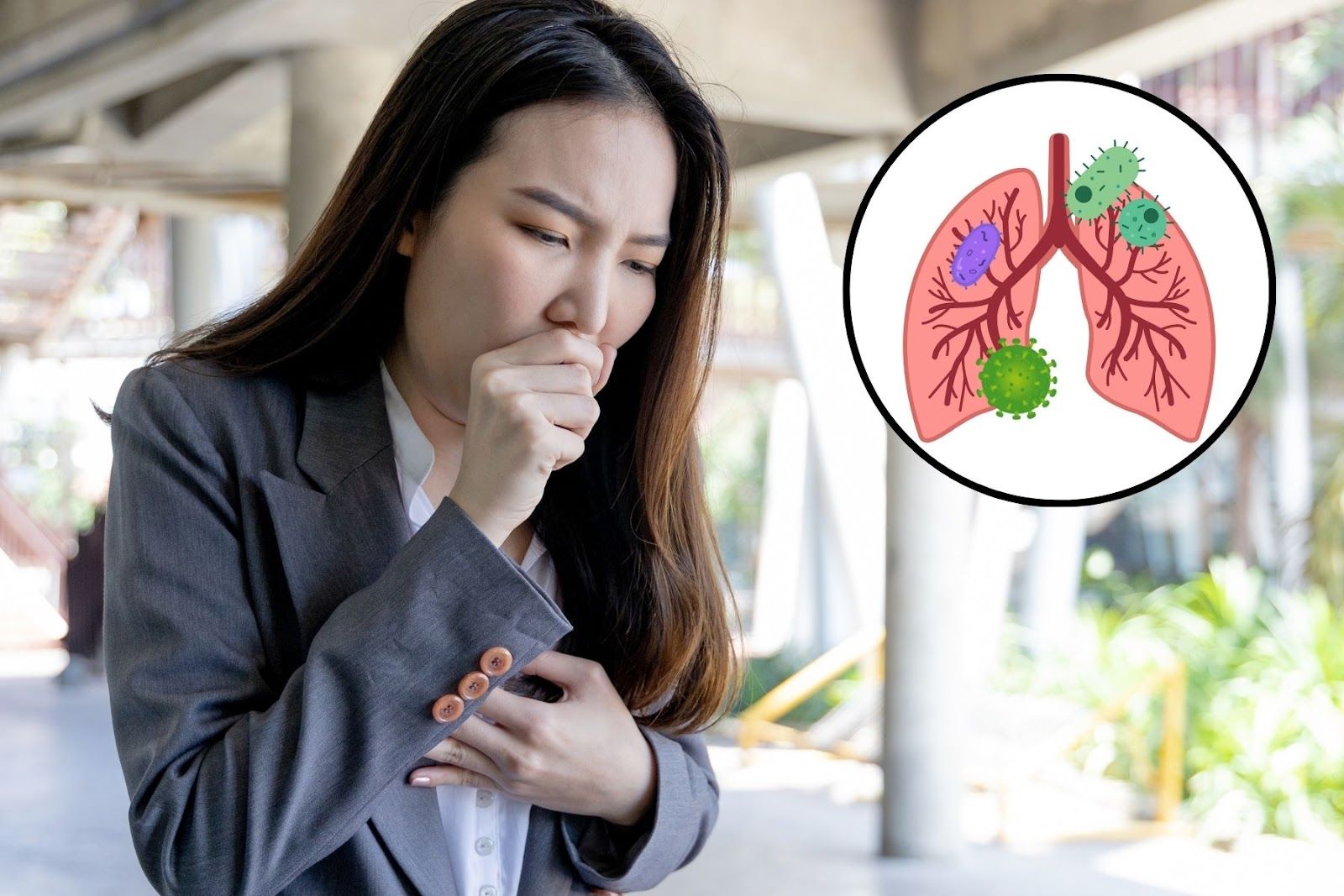 Viêm phổi cộng đồng là tình trạng nhiễm trùng nhu mô phổi (Nguồn: Canva)