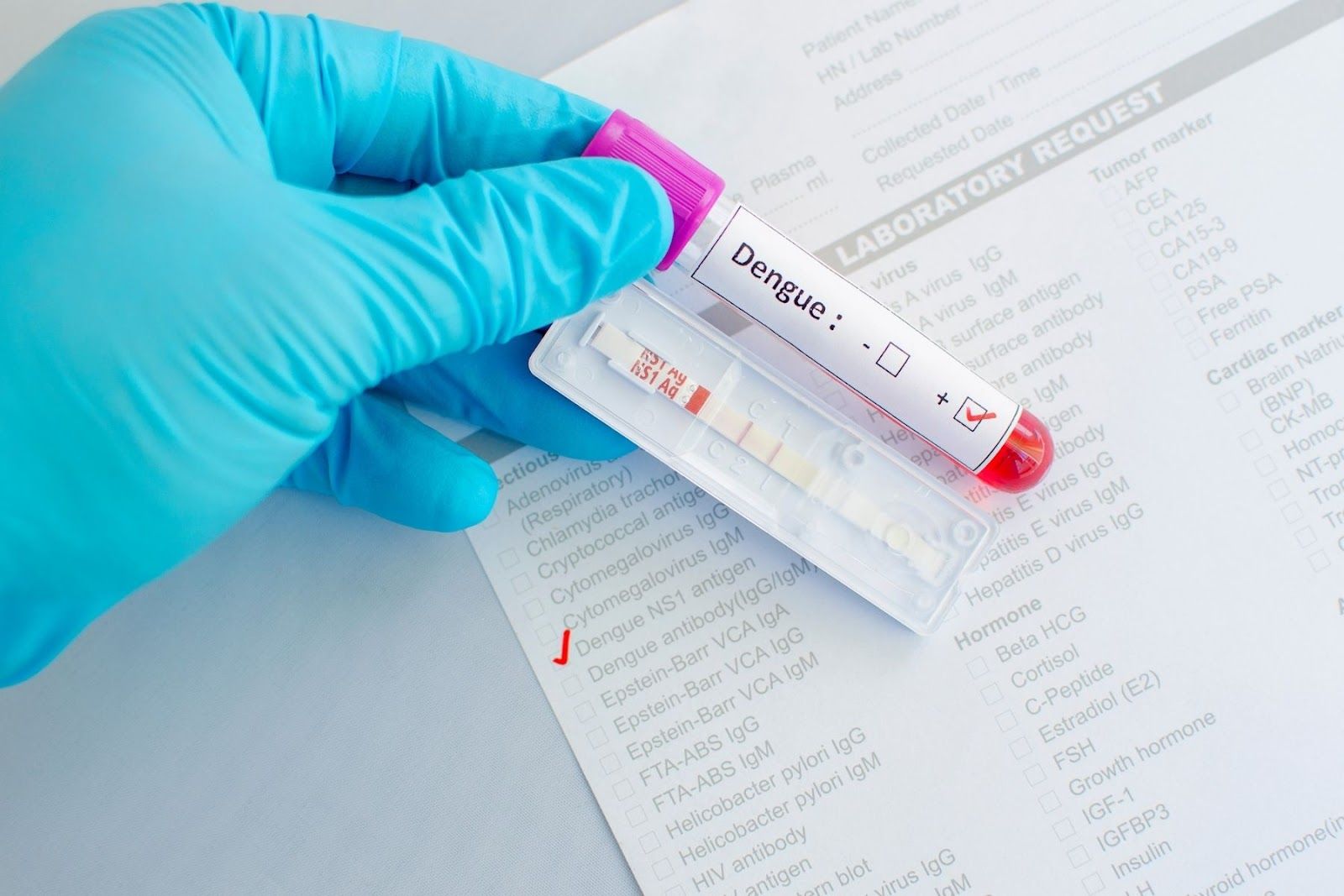 Người bị sốt xuất huyết do nhiễm virus Dengue (Nguồn: Canva)